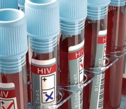 Yeni HIV aşısının denemelerine başlandı